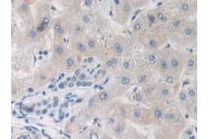 Detection of TNFa in Human Liver Tissue using Polyclonal Antibody to Tumor Necrosis Factor Alpha (TNFa) (TNF alpha anticorps  (AA 77-233))