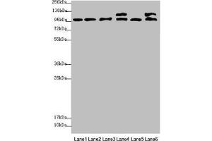 Western blot All lanes: NAA25 antibody at 2. (NAA25 anticorps  (AA 703-972))