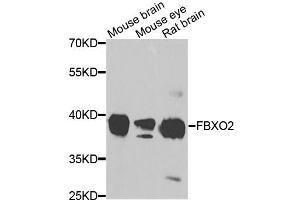 Western blot analysis of extracts of various cell lines, using FBXO2 antibody. (FBXO2 anticorps)