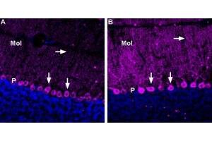 Expression of GABA(A) ε receptor in rat and mouse cerebellaImmunohistochemical staining of mouse and rat cerebellum using Anti-GABA(A) ε Receptor (GABRE) (extracellular) Antibody (ABIN7581874).