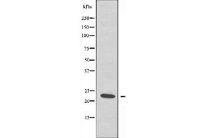 Western blot analysis of extracts from Jurkat cells, using BST2 antibody. (BST2 anticorps  (Internal Region))