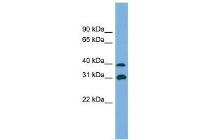 Crystallin Mu antibody used at 1 ug/ml to detect target protein. (CRYM anticorps  (Middle Region))