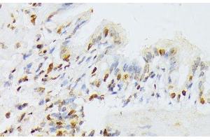 Immunohistochemistry of paraffin-embedded Rat lung using ANKRD52 Polyclonal Antibody at dilution of 1:100 (40x lens). (ANKRD52 anticorps)