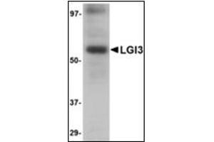 Western blot analysis of LGI3 in human brain tissue lysate with LGI3 antibody at 1 µg/ml.
