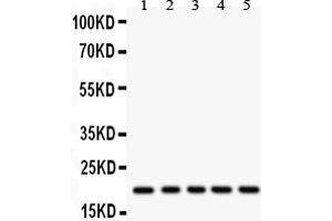 Anti- RAC1 Picoband antibody, Western blotting All lanes: Anti RAC1  at 0. (RAC1 anticorps  (C-Term))