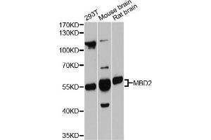 Western blot analysis of extracts of various cell lines, using MBD2 antibody (ABIN5998188) at 1:3000 dilution. (MBD2 anticorps)