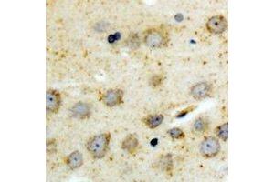 Immunohistochemical analysis of BID (pS78) staining in human brain formalin fixed paraffin embedded tissue section. (BID anticorps  (pSer78))