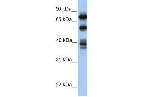 WB Suggested Anti-STRBP Antibody Titration:  0.
