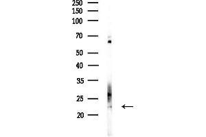 Western blot analysis of lysates from COLO205 cells(UV,30 min treatment), using COMM Antibody at 1/1000 dilution.