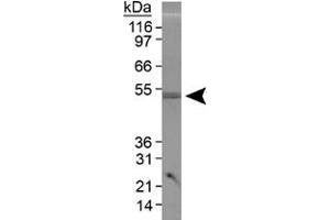 Western blot analysis of PLIN3 in 3T3-L1 lysate using PLIN3 polyclonal antibody . (PLIN3 anticorps  (AA 350-435))