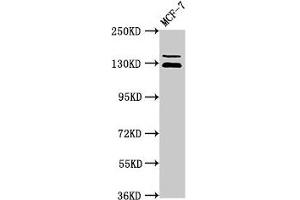 Western Blot Positive WB detected in: MCF-7 whole cell lysate All lanes: ZNF335 antibody at 3.
