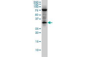 EDA2R monoclonal antibody (M02), clone 3C1. (Ectodysplasin A2 Receptor anticorps  (AA 1-110))