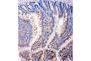 Anti-SMAD5 antibody, IHC(P) IHC(P): Rat Intestine Tissue