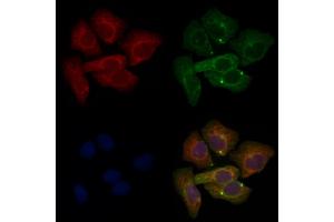 ABIN6265691 and ABIN6276606 staining Hela cells by IF/ICC. (TPM3 anticorps  (N-Term))