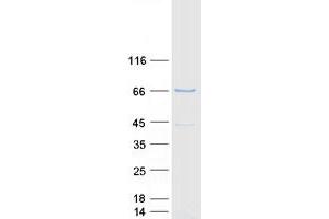 Validation with Western Blot