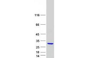 Validation with Western Blot