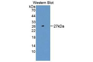 Western blot analysis of the recombinant protein. (NASP anticorps  (AA 3-223))