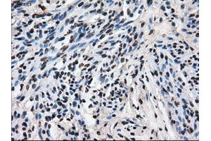 Immunohistochemical staining of paraffin-embedded Ovary tissue using anti-LEMD3mouse monoclonal antibody. (LEMD3 anticorps)
