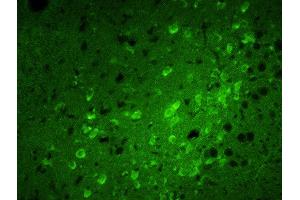 Formalin-fixed and paraffin embedded rat brain labeled with Rabbit Anti-Calreticulin Polyclonal Antibody, FITC Conjugated  at 1:100 for 40 minutes at 37°C. (Calreticulin anticorps  (AA 101-200) (FITC))