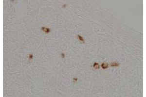 Imunohistochemical analysis of rat stomach tissue, using Ghrl polyclonal antibody  . (Ghrelin anticorps)
