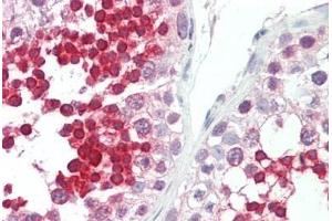 Human Testis: Formalin-Fixed, Paraffin-Embedded (FFPE) (ROPN1L anticorps  (C-Term))