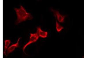 ABIN6276250 staining Hela by IF/ICC.