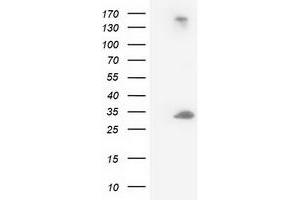 Western Blotting (WB) image for anti-Deoxycytidine Kinase (DCK) antibody (ABIN1497775) (DCK anticorps)