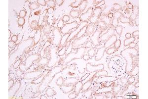 Paraformaldehyde-fixed, paraffin embedded mouse kidney tissue, Antigen retrieval by boiling in sodium citrate buffer(pH6) for 15min, Block endogenous peroxidase by 3% hydrogen peroxide for 30 minutes, Blocking buffer (normal goat serum) at 37°C for 20min, Antibody incubation with Rabbit Anti-CD34 Polyclonal Antibody, Unconjugated  at 1:200 overnight at 4°C, followed by a conjugated secondary and DAB staining