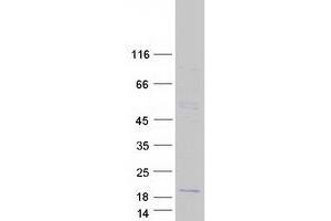 Validation with Western Blot