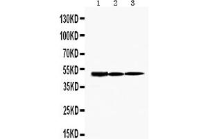Western blot analysis of KIM1 using anti-KIM1 antibody . (HAVCR1 anticorps  (C-Term))