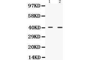 Western Blotting (WB) image for anti-NDRG Family Member 2 (NDRG2) (AA 210-247), (C-Term) antibody (ABIN3043261) (NDRG2 anticorps  (C-Term))