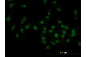 Immunofluorescence of monoclonal antibody to TOE1 on HeLa cell.