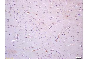 Formalin-fixed and paraffin embedded human brain with labeled Anti-TIE1 Polyclonal Antibody, Unconjugated (ABIN675099) at 1:200, followed by conjugation to the secondary antibody and DAB staining (TIE1 anticorps  (AA 851-1000))