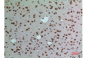 Immunohistochemistry (IHC) analysis of paraffin-embedded Rat Brain, antibody was diluted at 1:100.