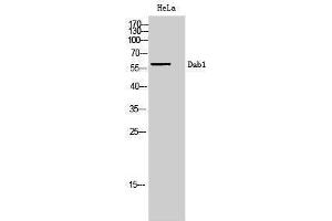 Western Blotting (WB) image for anti-Disabled Homolog 1 (Drosophila) (DAB1) (Ser295) antibody (ABIN3174701) (DAB1 anticorps  (Ser295))