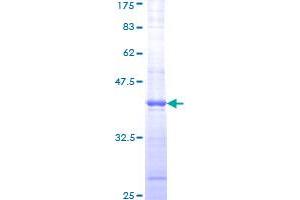 Image no. 1 for Ataxia Telangiectasia Mutated (ATM) (AA 1-100) protein (GST tag) (ABIN1345996)