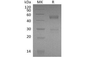Western Blotting (WB) image for Nephroblastoma Overexpressed (NOV) protein (His tag) (ABIN7320620) (NOV Protein (His tag))
