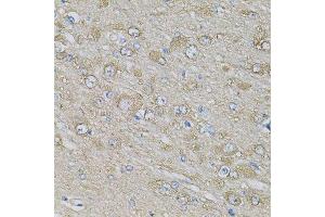 Immunohistochemistry of paraffin-embedded rat brain using EIF3H Antibody.