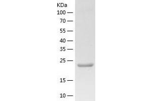 Western Blotting (WB) image for Pregnancy Zone Protein (PZP) (AA 603-829) protein (His-IF2DI Tag) (ABIN7124553)