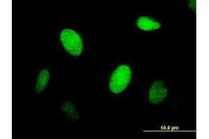 Immunofluorescence of purified MaxPab antibody to CENPJ on HeLa cell. (CENPJ anticorps  (AA 1-372))