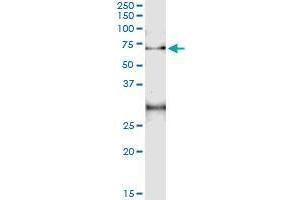 ACD (Human) IP-WB Antibody Pair