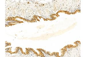 ABIN7094899 and ABIN7098952 at 1/100 staining Rat lung tissue by IHC-P.