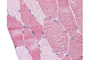 IHC-P Image Immunohistochemical analysis of paraffin-embedded human skeletal muscle , using DAP5, antibody(10 μg/ml).