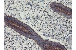 Image no. 6 for anti-Golgi Membrane Protein 1 (GOLM1) antibody (ABIN1498491)