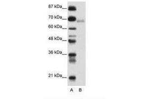 Image no. 1 for anti-Zinc Finger and BTB Domain Containing 22 (ZBTB22) (AA 421-470) antibody (ABIN6736152) (ZBTB22 anticorps  (AA 421-470))