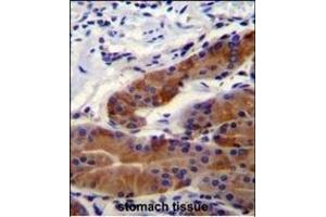 DFNB31 Antibody (Center) (ABIN655065 and ABIN2844695) immunohistochemistry analysis in formalin fixed and paraffin embedded stomach tissue followed by peroxidase conjugation of the secondary antibody and DAB staining.