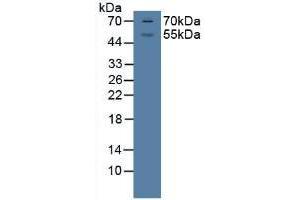Western Blot; Sample: Porcine Brian Tissue. (Glucocorticoid Receptor anticorps  (AA 598-755))
