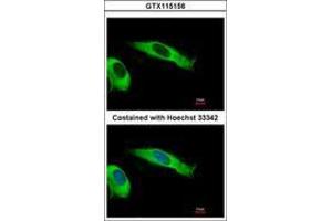 Image no. 2 for anti-Eukaryotic Translation Initiation Factor 2, Subunit 2 Beta, 38kDa (EIF2S2) (AA 1-216) antibody (ABIN1497973)