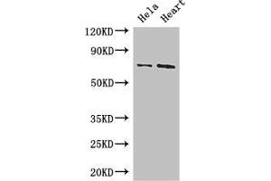 Western Blot Positive WB detected in: Hela whole cell lysate, Mouse heart tissue All lanes: PCK2 antibody at 3. (PEPCK anticorps  (AA 101-400))