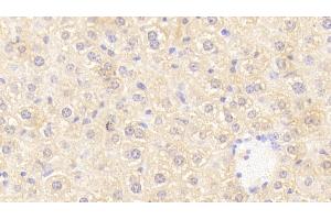 Detection of OSMR in Mouse Liver Tissue using Polyclonal Antibody to Oncostatin M Receptor (OSMR) (Oncostatin M Receptor anticorps  (AA 410-652))